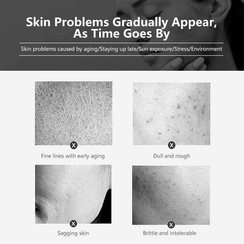 JOYRUQO Bifid Yeast Anti Wrinkle Firming Wrinkle Lightening Essence jiaorunquan 娇润泉二裂酵母次抛精华液 七老板推