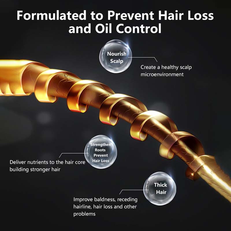 【BodyAid】Ginger Anti-Hair Fall Shampoo Anti Dandruff Fine Foam Prevent Hair Loss Stronger Hair