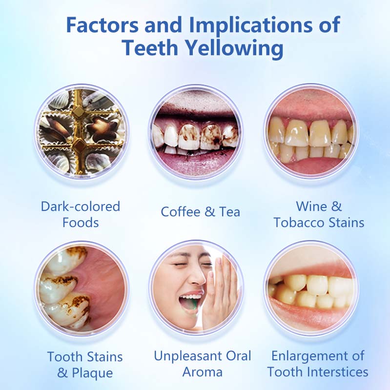 BodyAid Niacinamide Whitening Toothpaste to Remove Tooth Stains Bad Breath Counter Toothpaste Oral Care