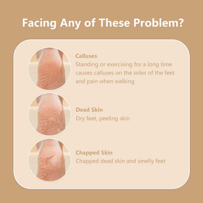 Electric Callus Remover Washable 1200mAh Battery Capacity