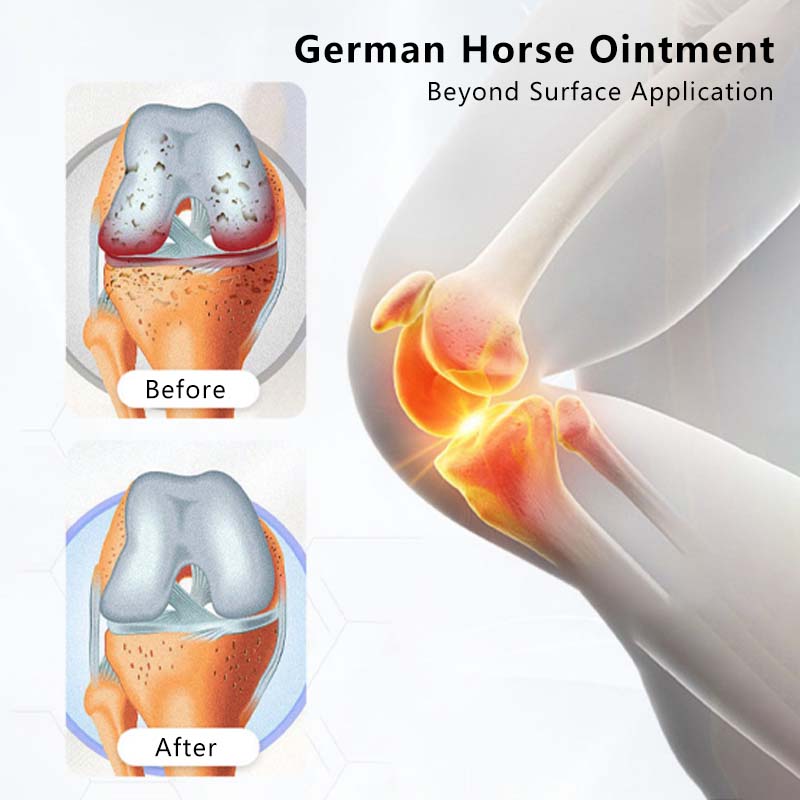 Horse Chestnut Massage Balm Gel Textured Balm Plant Formulated Non Greasy and Fast Absorption